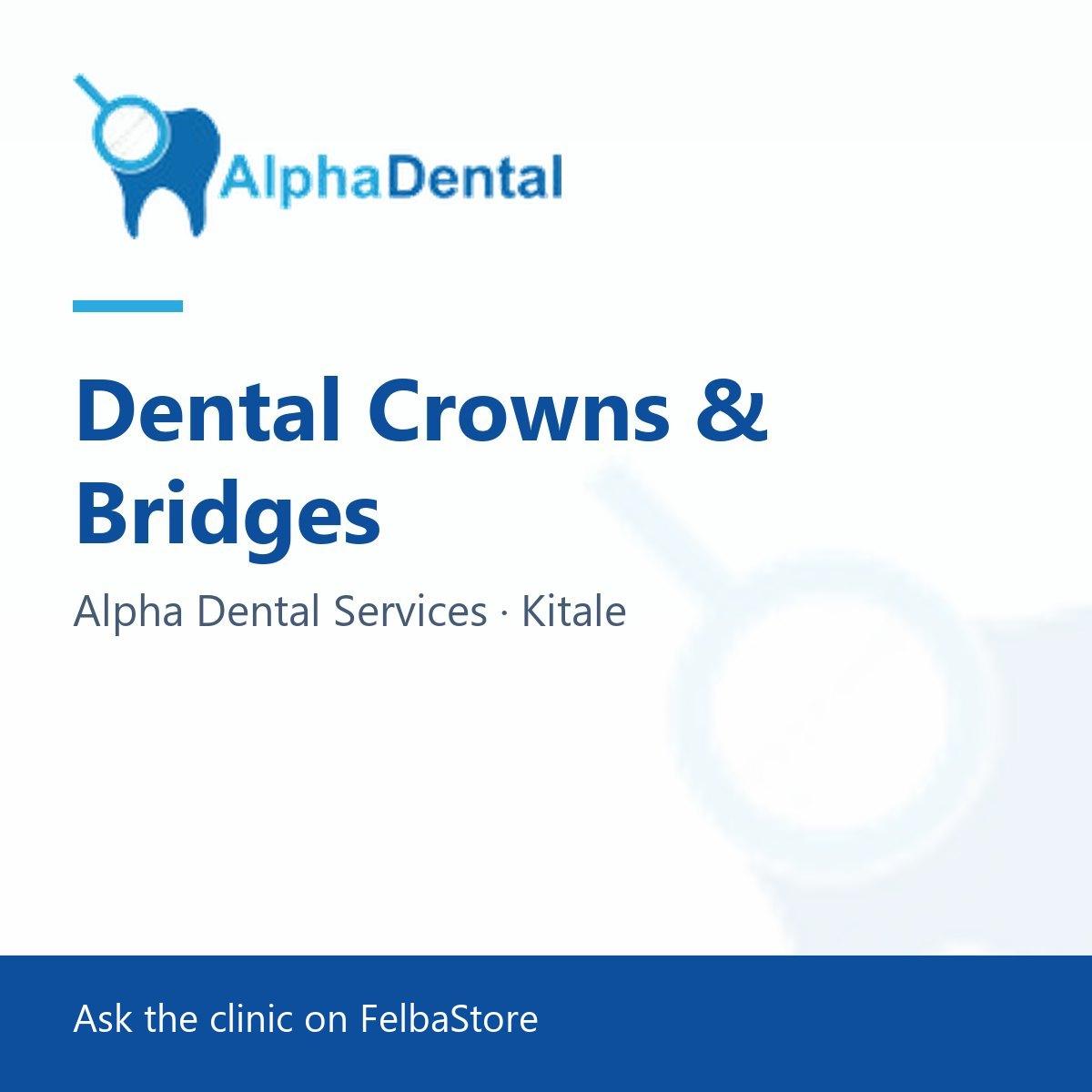 Dental Crowns & Bridges