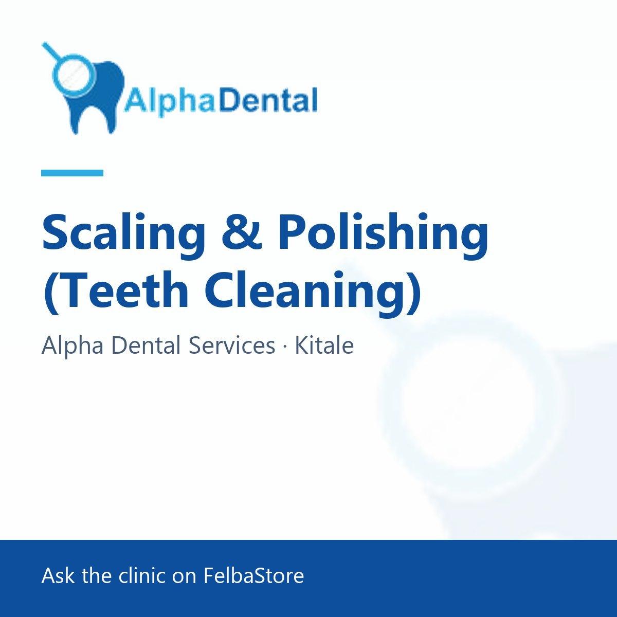 Scaling & Polishing (Teeth Cleaning)
